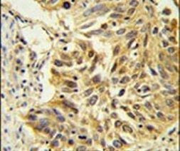 SDPR Antibody in Immunohistochemistry (IHC)