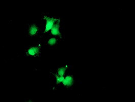 SDS Antibody in Immunocytochemistry (ICC/IF)