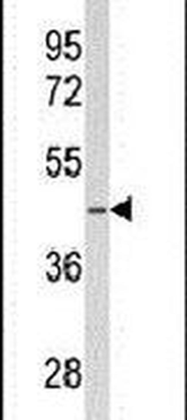 SDS Antibody in Western Blot (WB)