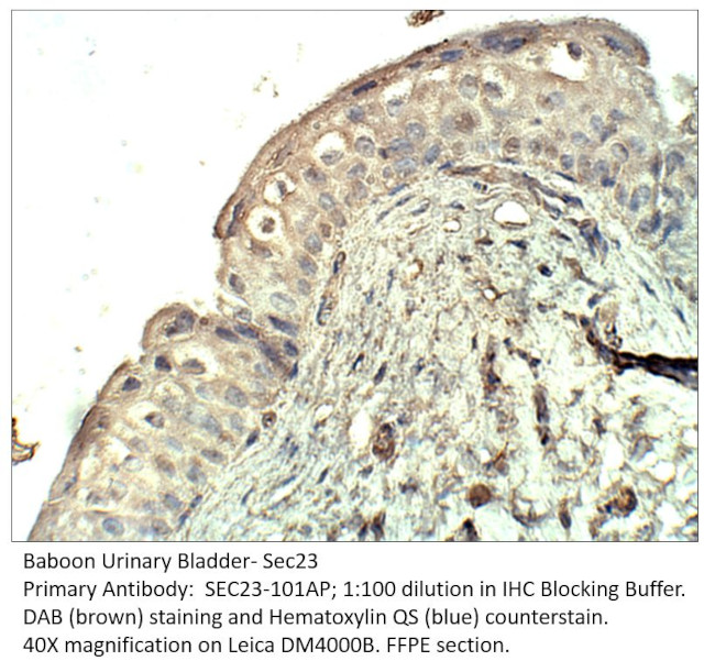 SEC23 Antibody in Immunohistochemistry (IHC)