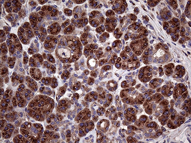 SEC23B Antibody in Immunohistochemistry (Paraffin) (IHC (P))