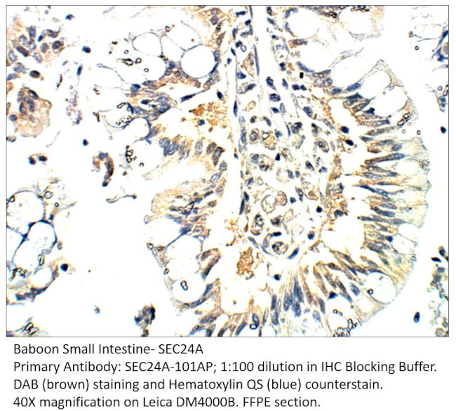 SEC24A Antibody in Immunohistochemistry (IHC)