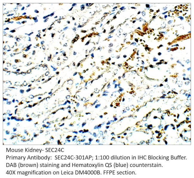SEC24C Antibody in Immunohistochemistry (IHC)