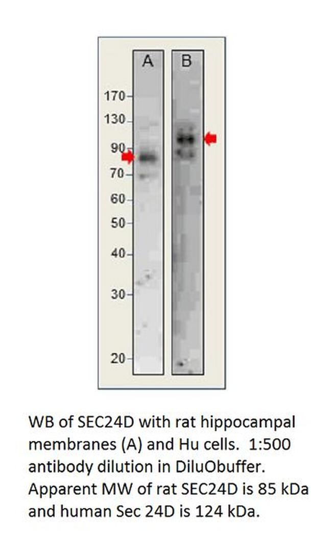 SEC24D Antibody in Western Blot (WB)