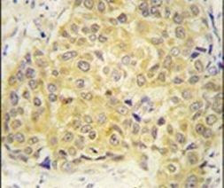 SEMA3A Antibody in Immunohistochemistry (IHC)