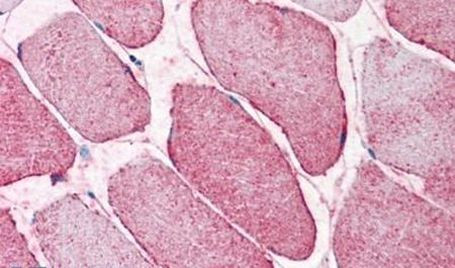 SEMA4B Antibody in Immunohistochemistry (Paraffin) (IHC (P))