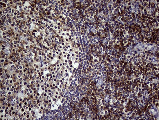 SEMA4D Antibody in Immunohistochemistry (Paraffin) (IHC (P))