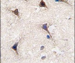 SEMA6A Antibody in Immunohistochemistry (IHC)