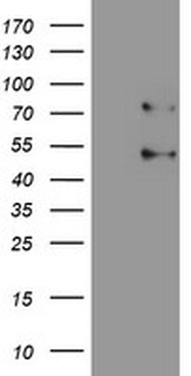 SENP1 Antibody in Western Blot (WB)