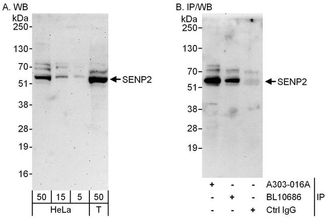SENP2 Antibody in Western Blot (WB)