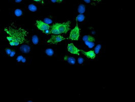 SENP2 Antibody in Immunocytochemistry (ICC/IF)