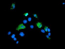SENP2 Antibody in Immunocytochemistry (ICC/IF)