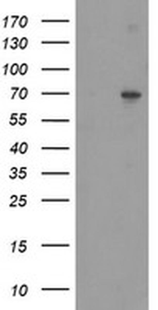 SENP2 Antibody in Western Blot (WB)
