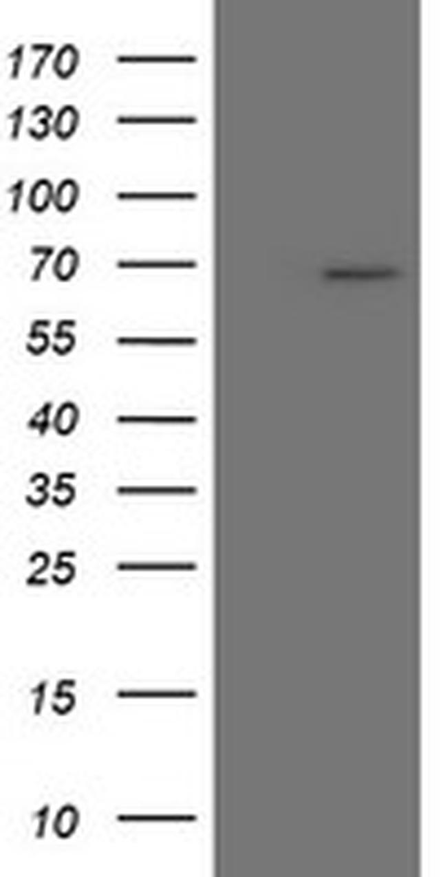 SENP2 Antibody in Western Blot (WB)