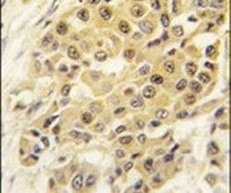 SENP3 Antibody in Immunohistochemistry (IHC)