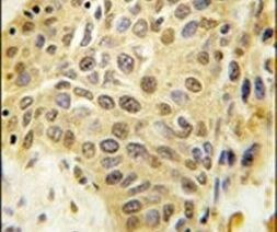 SENP5 Antibody in Immunohistochemistry (IHC)
