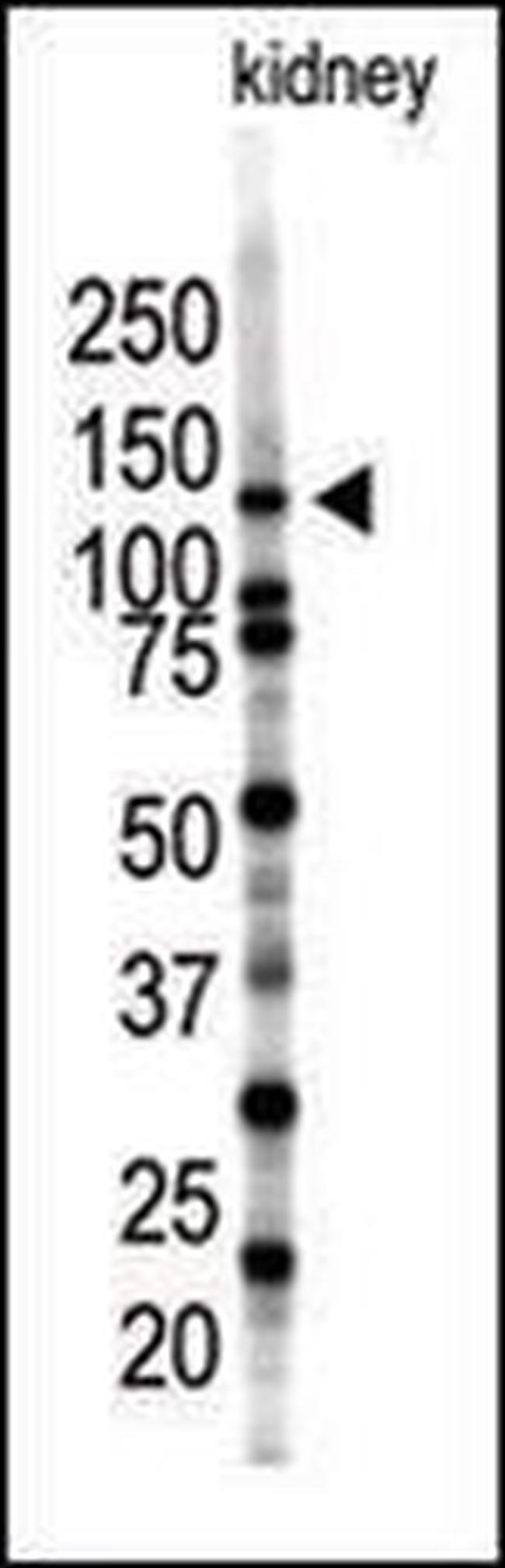 SENP7 Antibody in Western Blot (WB)