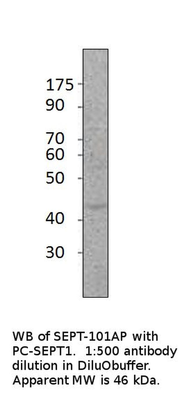 SEPT1 Antibody in Western Blot (WB)