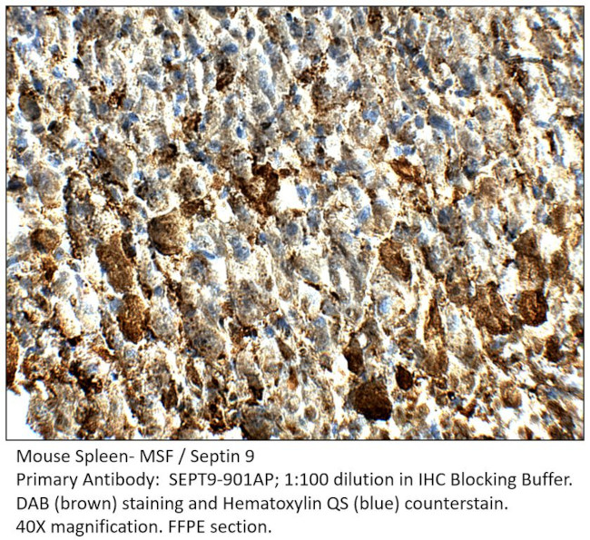 MSF Antibody in Immunohistochemistry (IHC)