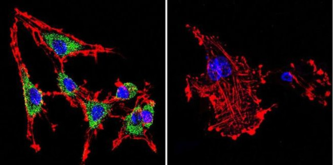 SERCA1 ATPase Antibody in Immunocytochemistry (ICC/IF)