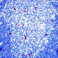 alpha-1 Antitrypsin Antibody in Immunohistochemistry (IHC)