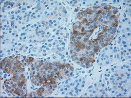 SERPINA1 Antibody in Immunohistochemistry (Paraffin) (IHC (P))