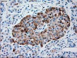 SERPINA1 Antibody in Immunohistochemistry (Paraffin) (IHC (P))