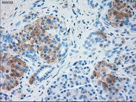 SERPINA1 Antibody in Immunohistochemistry (Paraffin) (IHC (P))