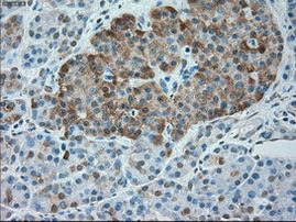 SERPINA1 Antibody in Immunohistochemistry (Paraffin) (IHC (P))