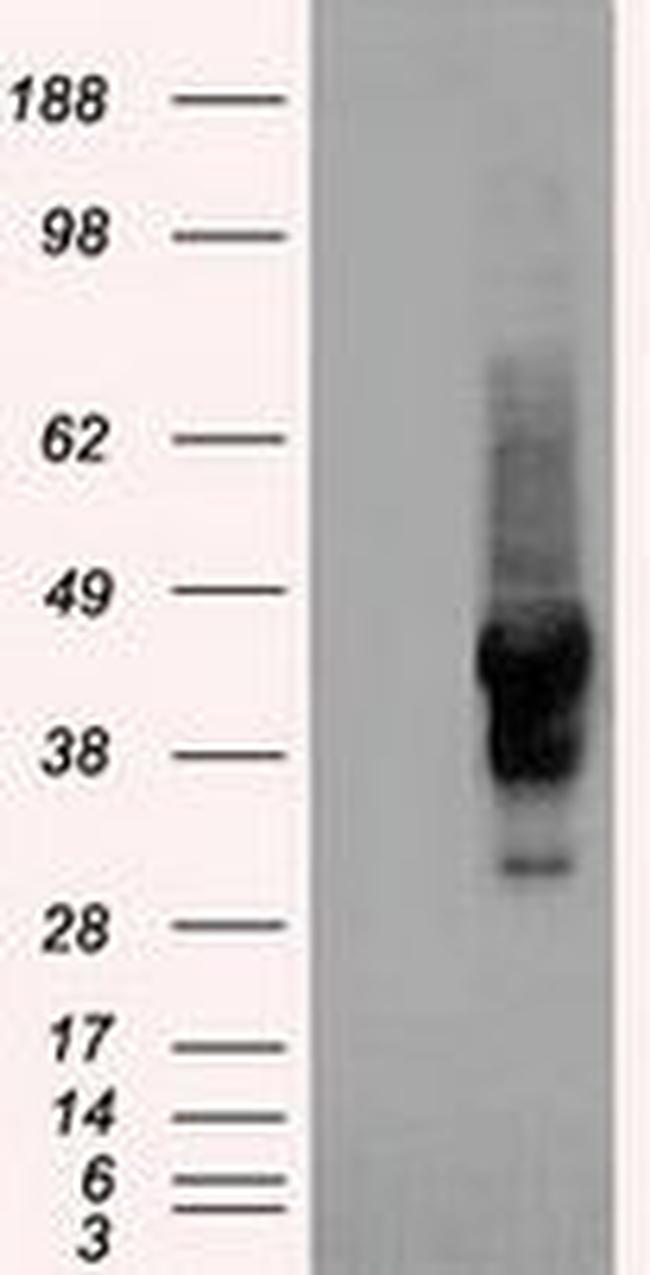 SERPINA1 Antibody in Western Blot (WB)
