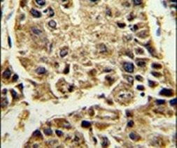 SERPINA4 Antibody in Immunohistochemistry (IHC)