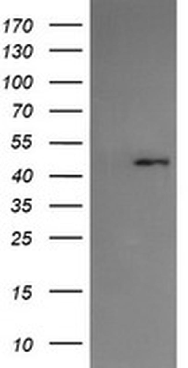 SERPINA5 Antibody in Western Blot (WB)