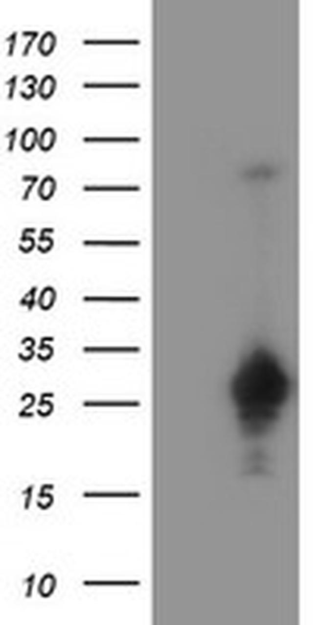 SERPINA5 Antibody in Western Blot (WB)
