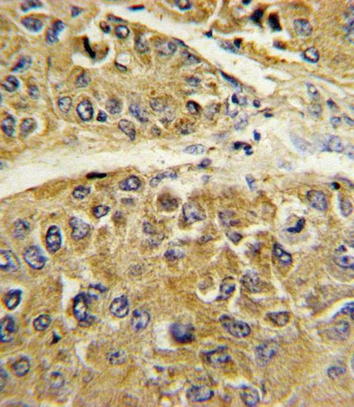 SERPINA7 Antibody in Immunohistochemistry (IHC)