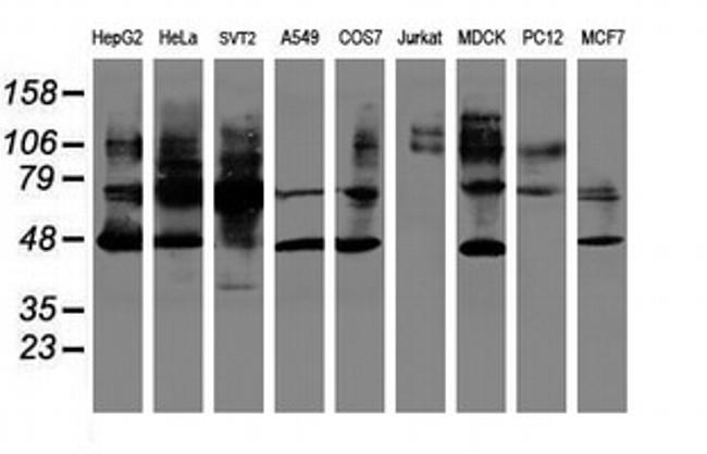 SERPINB1 Antibody in Western Blot (WB)