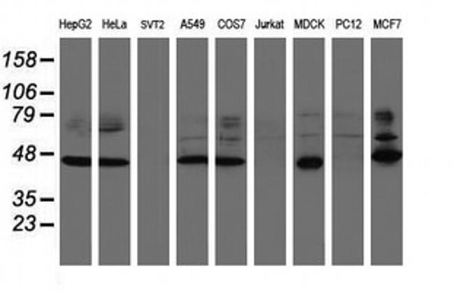 SERPINB1 Antibody in Western Blot (WB)