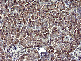 SERPINB3 Antibody in Immunohistochemistry (Paraffin) (IHC (P))