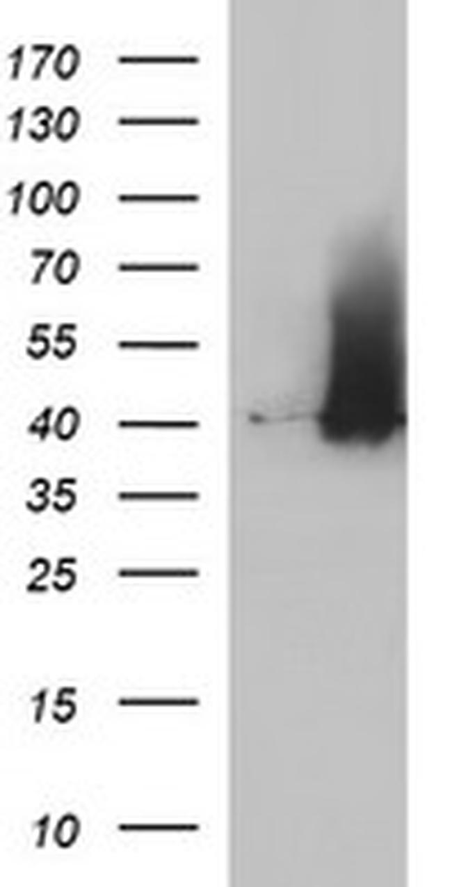 SERPINB3 Antibody in Western Blot (WB)