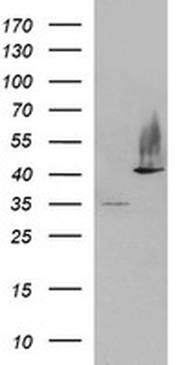 SERPINB3 Antibody in Western Blot (WB)