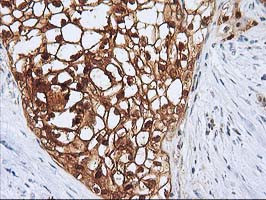 SERPINB4 Antibody in Immunohistochemistry (Paraffin) (IHC (P))