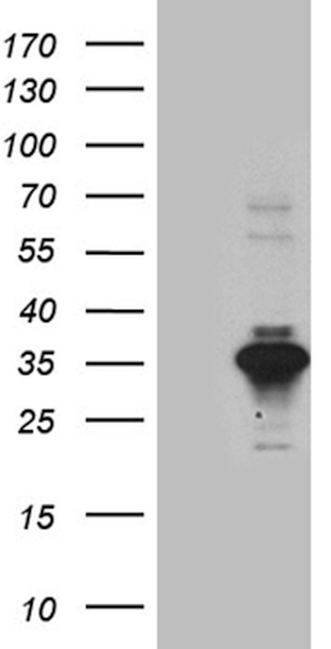 SERPINB8 Antibody in Western Blot (WB)