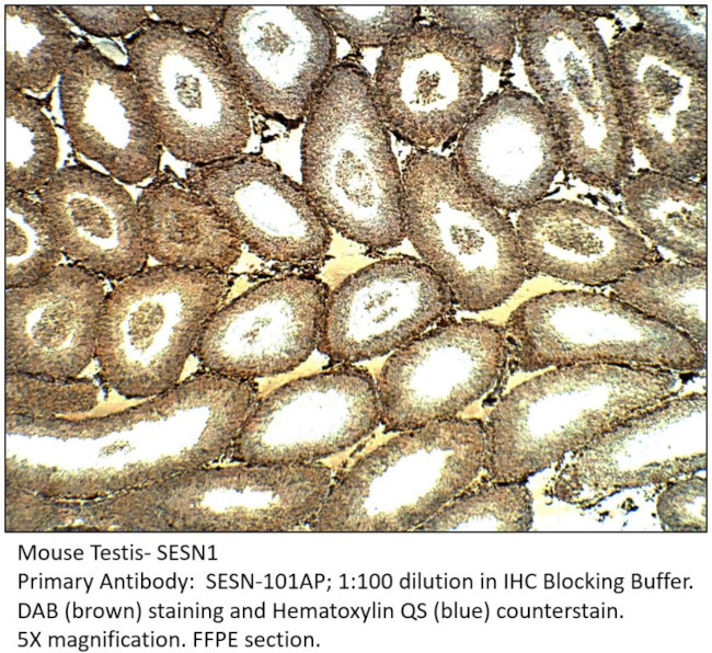 SESN1 Antibody in Immunohistochemistry (IHC)