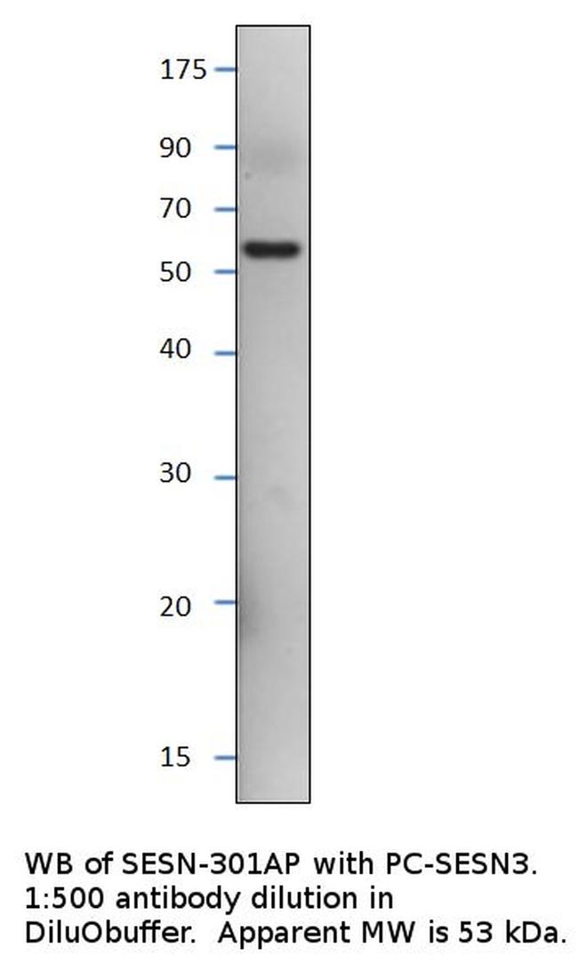 SESN3 Antibody in Western Blot (WB)