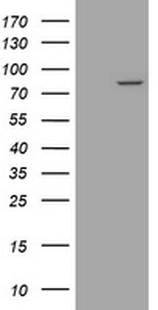 SESTD1 Antibody in Western Blot (WB)