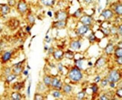 SETD8 Antibody in Immunohistochemistry (IHC)
