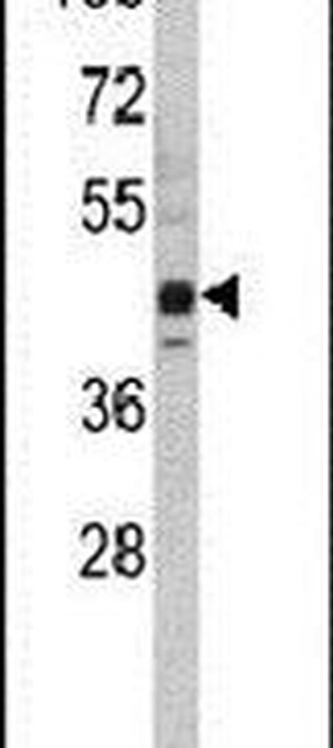 SETD8 Antibody in Western Blot (WB)