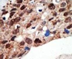 SETD7 Antibody in Immunohistochemistry (IHC)