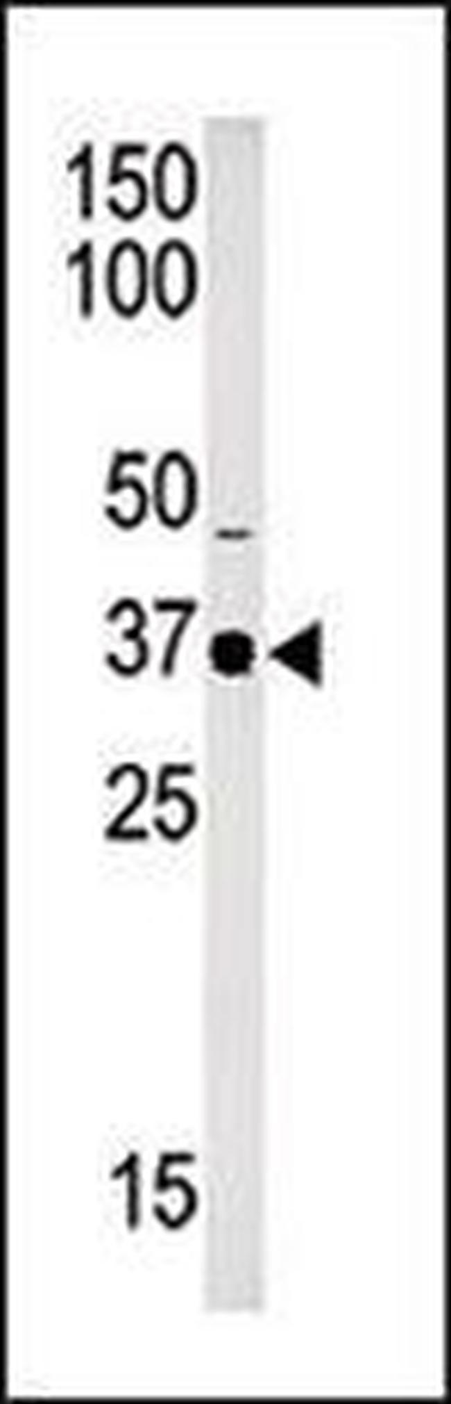 SETD7 Antibody in Western Blot (WB)