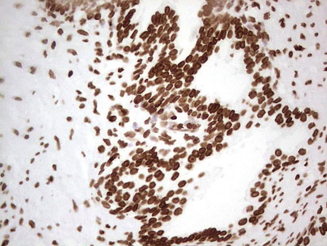SETD1A Antibody in Immunohistochemistry (Paraffin) (IHC (P))