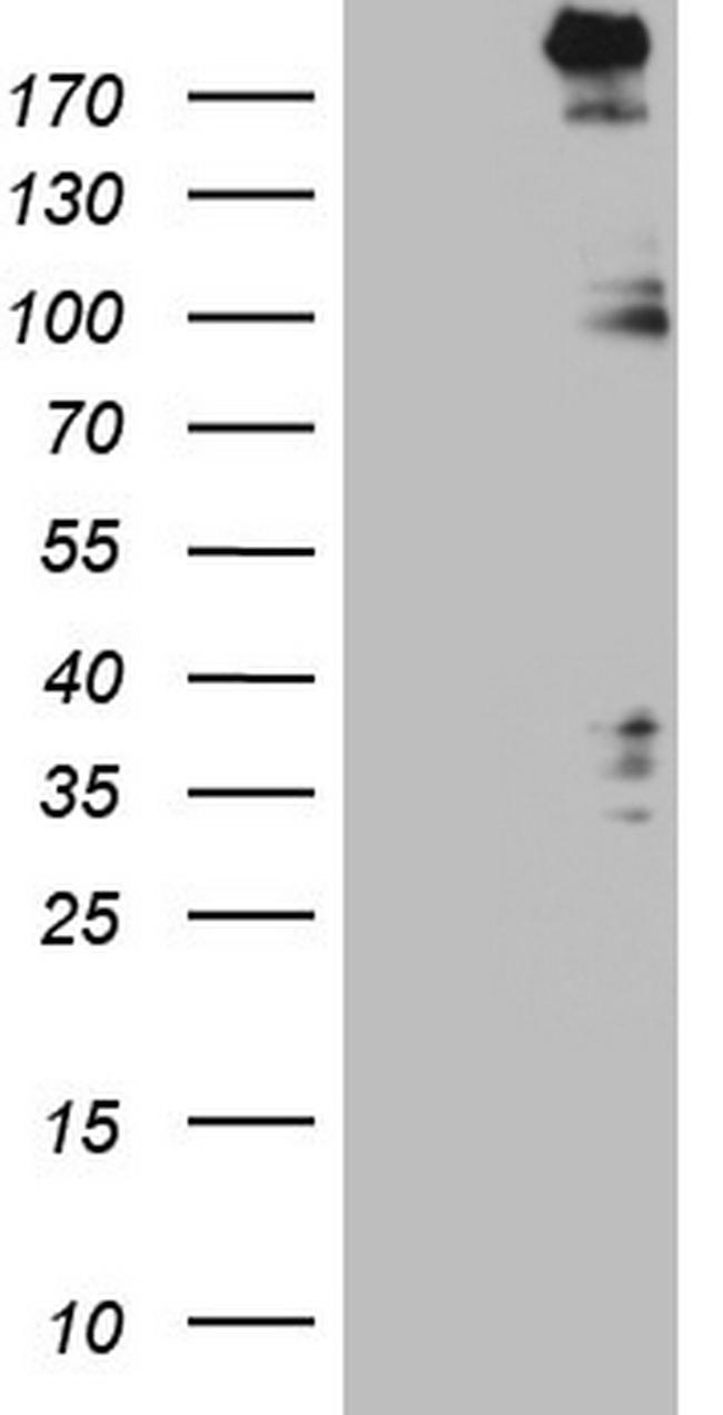 SETD1A Antibody in Western Blot (WB)